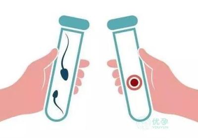 一代、二代、三代试管婴儿有什么不同？别再盲目追“高级版”了