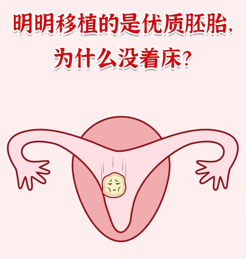导致试管婴儿移植失败的原因有哪些