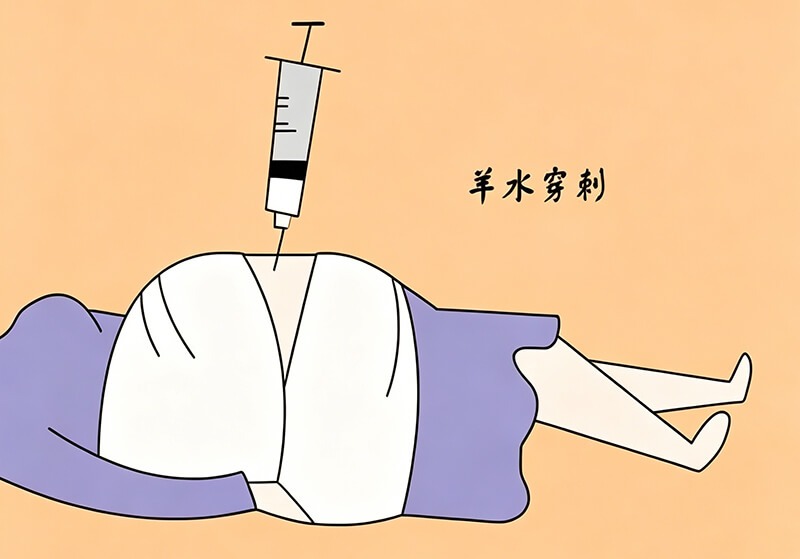 试管怀孕后产前诊断