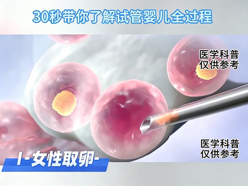 试管婴儿流程步骤