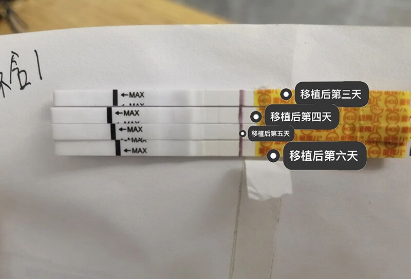 试管移植后的黄金48小时，休息要适度